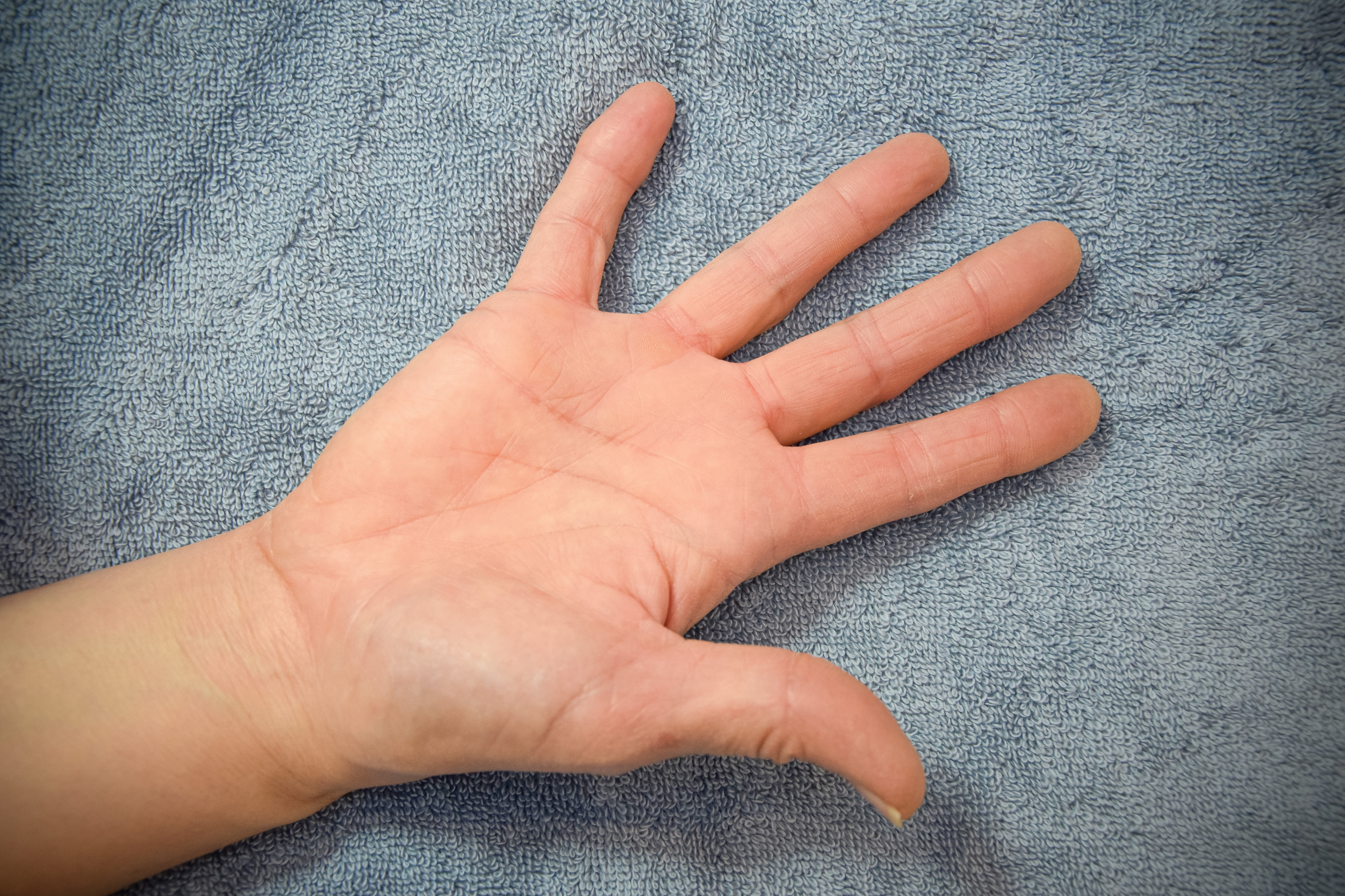 Hand treatment image detail view