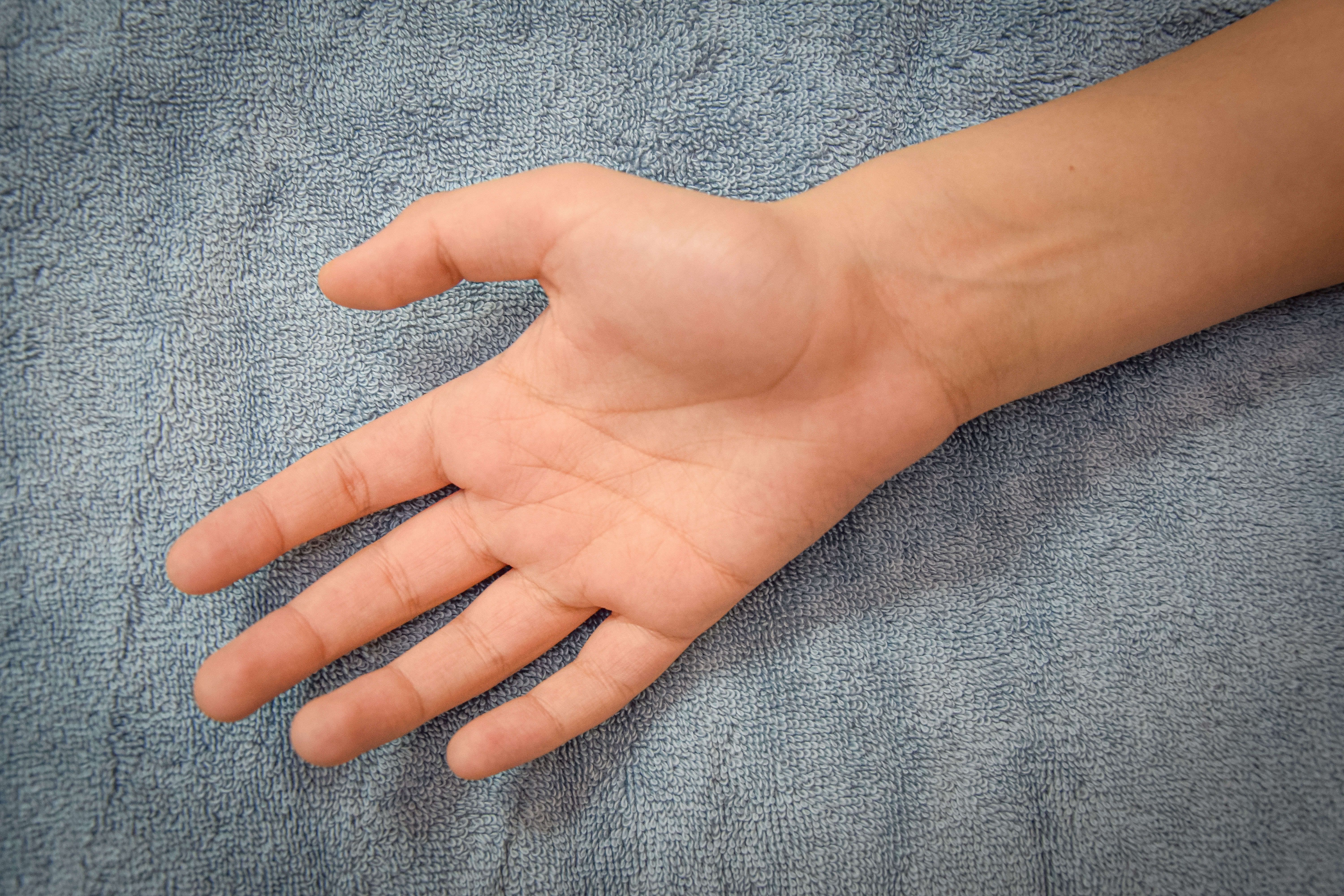 Hand treatment image before view